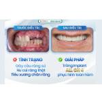Trồng Răng Implant Profile Picture
